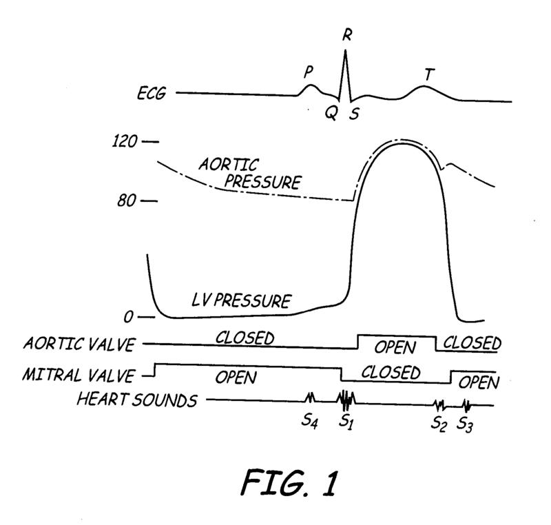 IMG_5.40_Heart_EGC_and_sound