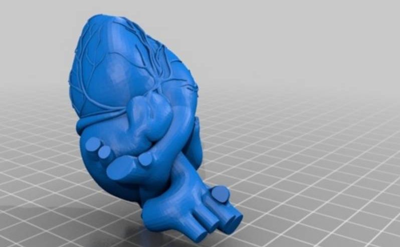 Screenshot_2_anatomic_heart