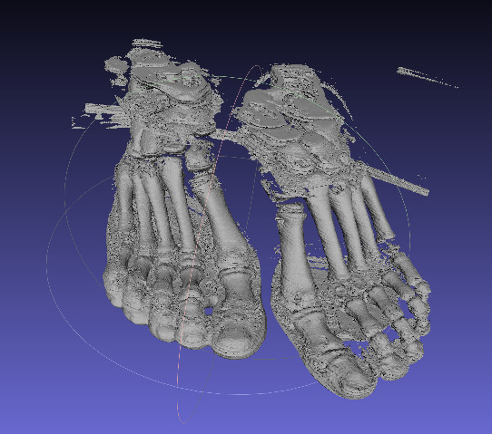 foot_stl.jpg