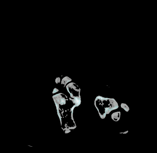 foot_bone_opt.gif